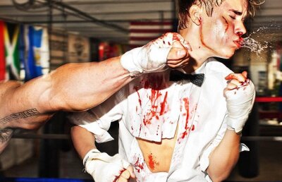 FOTO! SOC! Justin Bieber, batut, insangerat si cu hainele rupte