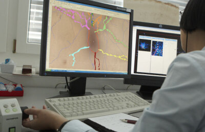 Durerile cronice, depresia şi dependenţa de droguri ar putea fi blocate graţie descifrării structurii "moleculelor plăcerii" din creier