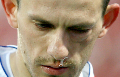 FOTO Imagini horror în Gruia » Sălăgeanu s-a ales cu fractură de pomete