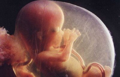 Americanii au realizat harta genomului unui făt de 18 săptămâni. Aceasta va permite depistarea oricărei afecţiuni genetice