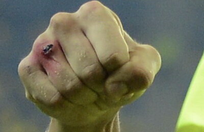 Geambaşu şi o imagine care vorbeşte cît 1000 de editoriale despre meseria de fotbalist » "Mîna lui Nikolici"