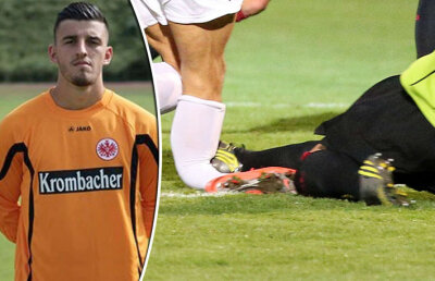 FOTO Fotbalul întunecat de două accidentări-horror! » Picior rupt ca un vreasc
