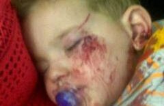 Băieţel ATACAT de VULTUR, în parc: "Era în şoc, cu ochiul umflat. I-a ciupit bucăţi de piele de pe obraz şi din cap"  - IMAGINI ŞOCANTE