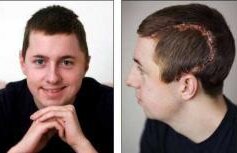 VIDEO. Un camion de 15 tone a trecut peste el, însă el a trişat moartea. Medicii i-au adunat corpul dezmembrat într-o pătură