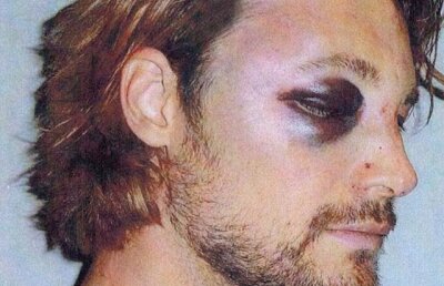 Galerie foto! Gabriel Aubry, desfigurat dupa bataia cu Olivier Martinez