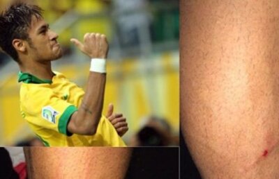 Plînge pentru o zgîrietură » Neymar a fost ironizat după ce şi-a arătat "rănile" de la meciul cu Honduras