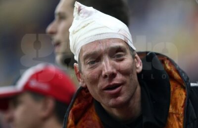Povestea suporterului care a fost bătut măr pe Arena Naţională, dar şi în urmă cu 15 ani, în deplasarea de la Budapesta!