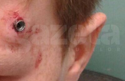 Împuşcat la marginea terenului! Un puşti s-a trezit cu un glonte în cap în timp ce aştepta să fie introdus în joc