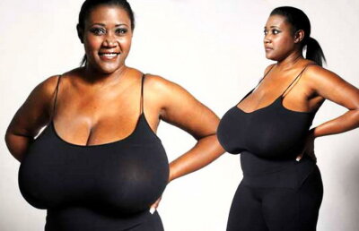 Avea sînii enormi şi a decis să se opereze! Rezultatul este uluitor