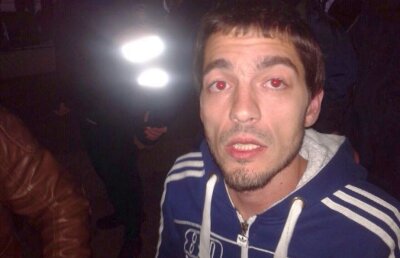 Atenție, imagini șocante! Fanii ruși s-au luat la bătaie cu moldovenii » Incidentele s-au lăsat cu victime pline de sînge