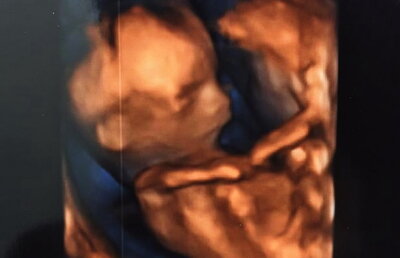 Ea este cea mai sexy graviduţă a momentului! Va avea o fetiţă