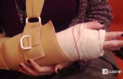 Victima lui Messi are mâna în ghips: "Nu-l plăceam nici până acum, dar acum îmi displace enorm!" » Ce le-a cerut fata celor de la Barcelona