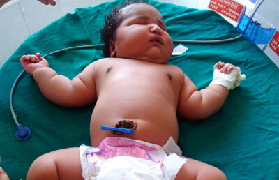 VIDEO » S-a născut fetiţa cu cea mai mare greutate din lume