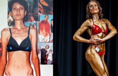 O femeie care cântărea puţin peste 30 de kilograme a decis să-şi schimbe viaţa! E incredibil ce s-a întâmplat