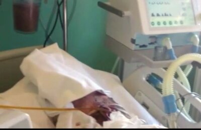 EXCLUSIV Mărturie înfiorătoare a unei infirmiere de la Spitalul de Arși: "Viermii apar în fiecare vară!". Și al doilea pacient cu larve a decedat