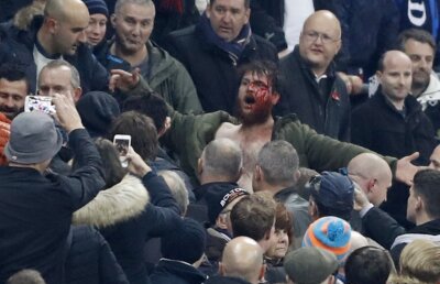 Sânge de Ziua Armistițiului » Ultrașii nu au ținut cont de comemorare: incidente dure la un meci de fotbal