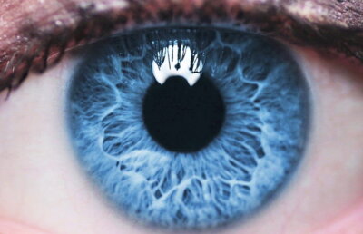 A mers la oftalmolog cu dureri la ochi. Este şocant ce a găsit doctorul în ochiul unei femei!