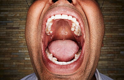 FOTO Vijay Kumar, bărbatul cu cei mai mulți dinți din lume