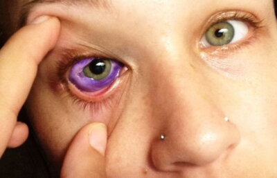 FOTO & VIDEO A vrut să îşi facă un tatuaj în ochi, însă ce a păţit este cu adevărat şocant!