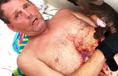 VIDEO Atenţie, imagini uluitoare. A ieşit din apă cu un rechin înfipt în abdomen!