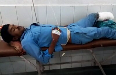 Atenție, imagini șocante! I-au pus piciorul amputat sub cap, în loc de pernă!