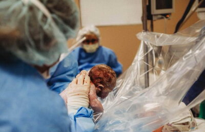 GALERIE FOTO O femeie și-a scos singură copilul din pântece, în timpul operației de cezariană