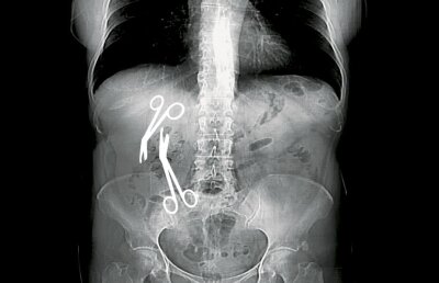 INVESTIGAȚIE Libertatea / Directorul medical al Spitalului Militar din Constanța a uitat două foarfeci de 16 cm în burta unei paciente de 61 de ani!