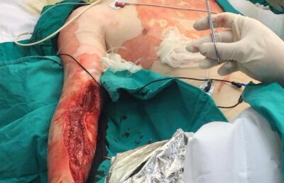 Secretele „Colectiv” în imagini și documente: chirurgul Emanuel Albu a cerut, încă din prima zi, în foaia de observație, transferul rănitului Roberto Vlăduț! Vlăduț pleacă ultimul și moare!