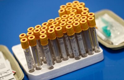 CORONAVIRUS. Ultima oră » 26 de cazuri noi și 65 decese în ultimele 24 de ore