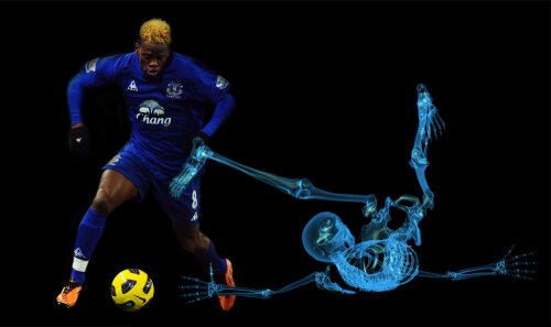 Louis Saha  - Fotomontaj: Dan Bucur