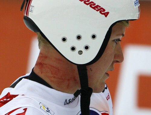 Iată cum arată Andrea Fischbacher după căzătura de pe pîrtie
sursa foto Reuters