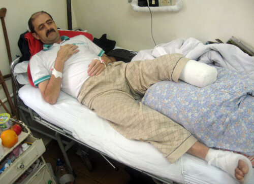 Aşa arăta Viorel Turcu în 2008, după ce i-a fost amputat piciorul stîng