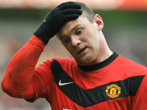 34.500 de euro l-a costat pe Rooney implantul de păr pe care l-a făcut în primăvară