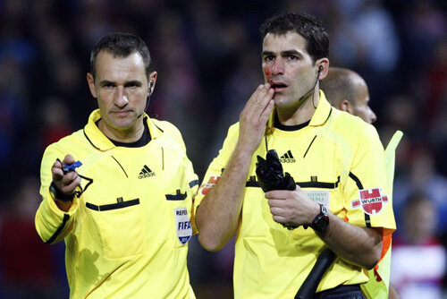 Asistentul Aguilar Rodriguez a fost lovit cu o umbrelă aruncată din peluză