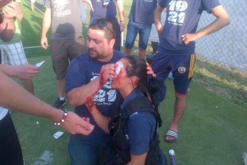 O femeie-jandarm a
fost lovită cu un
bolovan în figură
Foto: glasul-hd.ro