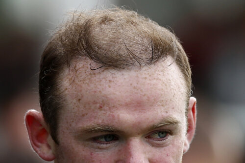 Implantul de păr l-a costat 17.600 de euro pe Rooney // Foto: Reuters