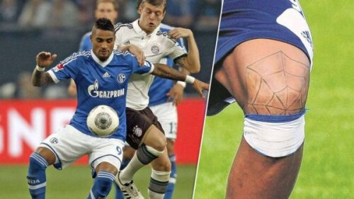 Boateng și-a tatuat pe genunchi o pînză de păianjen ca să ascundă urmele operațiilor