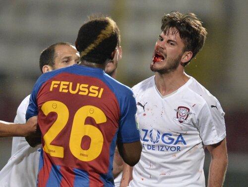 Momentul horror al meciului: Oriol a rămas fără un dinte