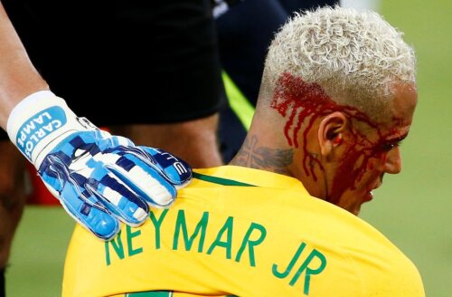 Neymar, plin de sânge // FOTO Reuters