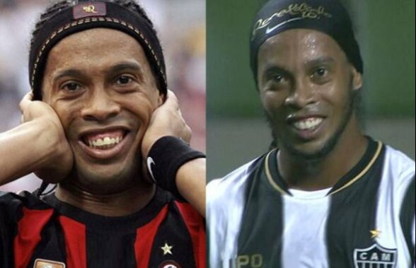 FOTO » Înainte şi după Ronaldinho nu mai e dinţos! Cum arată după intervenţia chirurgicală