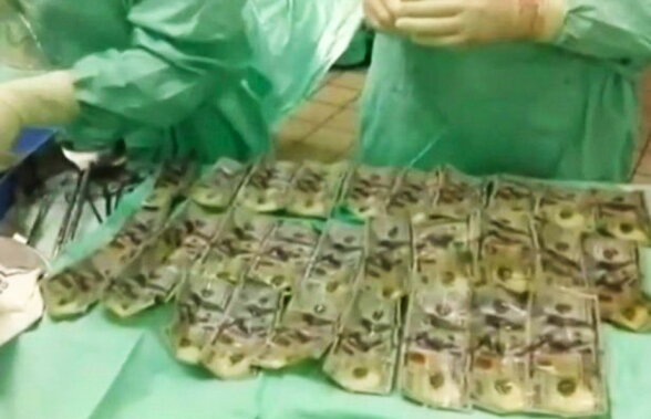 VIDEO O femeie a înghiţit 7.000 de dolari. Vezi motivul halucinant!