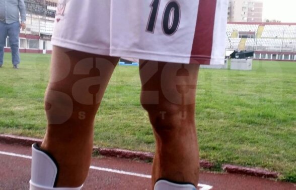 FOTO Incident la Rapid - Dinamo: Pancu, furios după ce un adversar i-a lăsat urme adânci pe genunchi. Mesaj pentru dinamovist