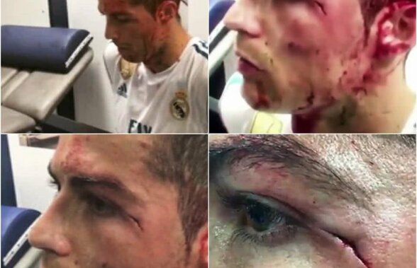 VIDEO și FOTO Imagini-șoc din vestiarul lui Real Madrid: Ronaldo, cu o rană adâncă și sângele șiroind pe față + Cum a apărut azi la antrenament