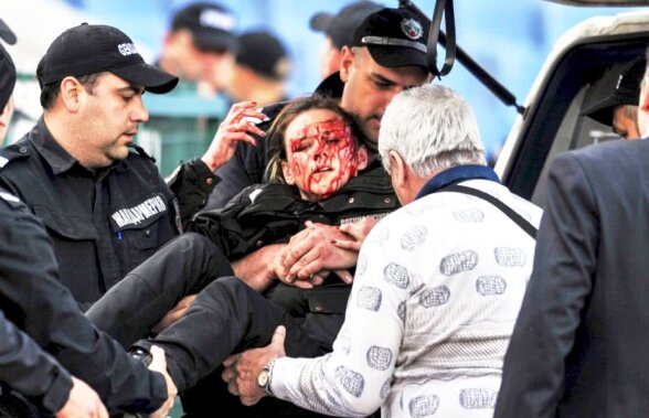 SCENE ȘOCANTE! O polițistă plină de sânge la derby: "Avea multe bucăți de sticlă pe față și în ochi. Nu a fost o petardă, ci o bombă"