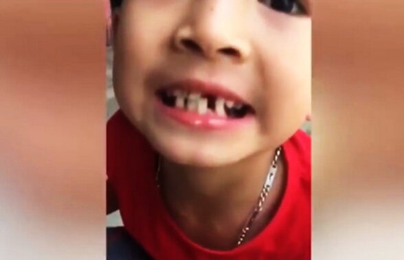 VIDEO Asta e cea mai tare metodă de a scoate un dinte copilului. Tu ai încerca la fel?