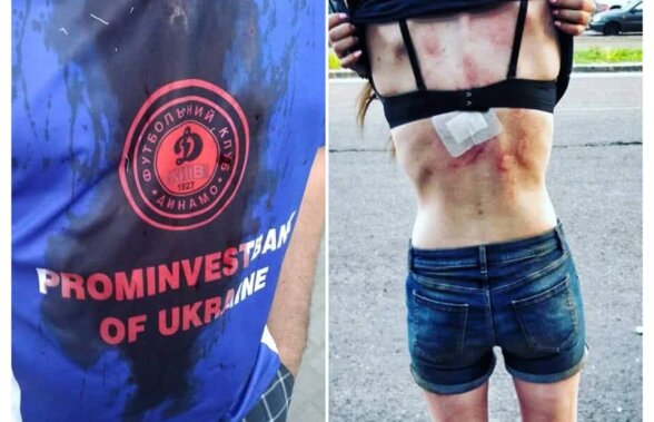 Scene șocante înaintea finalei Cupei Ucrainei: fată de 18 ani bătută crunt, alți fani însângerați