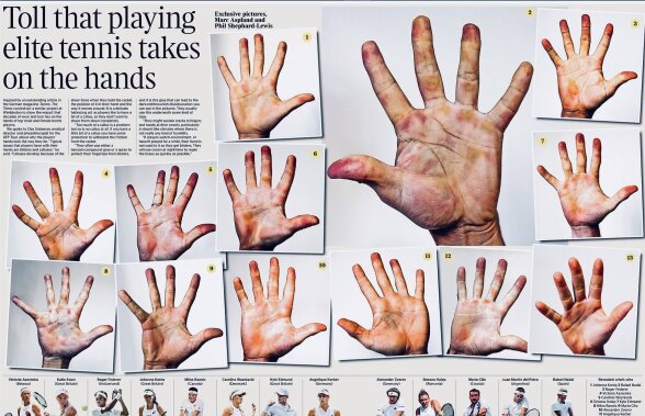 FOTO Așa arată sacrificiul » Cât de afectate sunt mâinile Simonei Halep și ale altor jucători de la Wimbledon