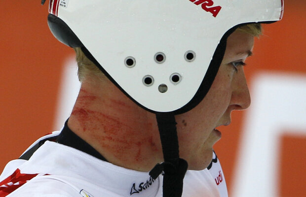 INCREDIBIL! Zgâriată pînă la sînge, după o căzătură la schi!