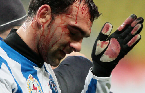 I-au spart capul lui Pleşan!