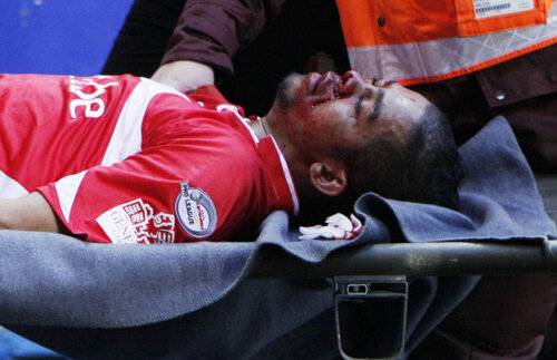 Încă o accidentare teribilă, în Belgia » Cu faţa zdrobită